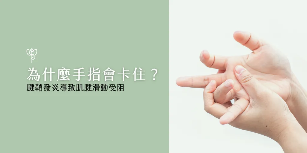 板機指成因示意圖，腱鞘發炎導致肌腱滑動受阻