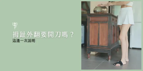 拇指外翻一定要開刀嗎？Espandi 拇指外翻護具