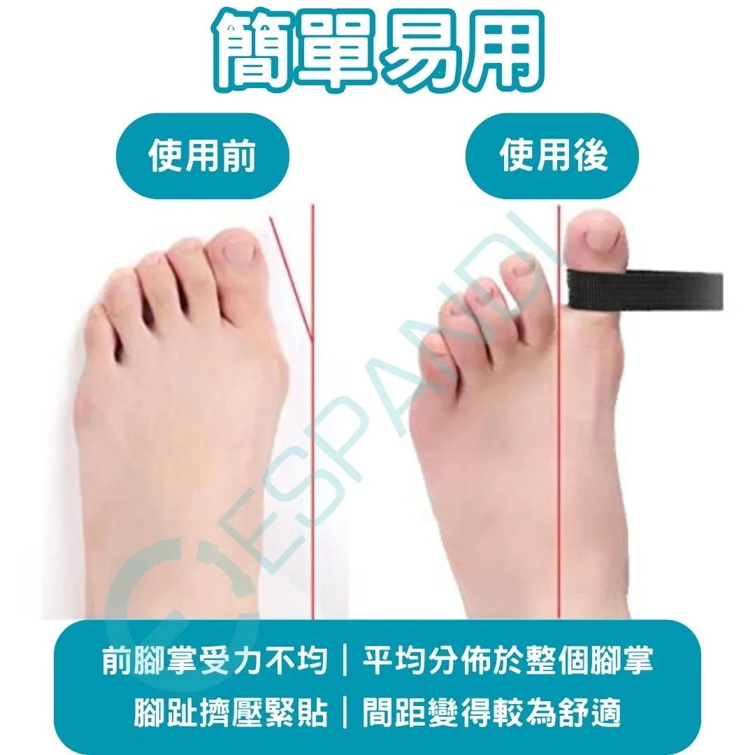 Espandi 腳趾伸展訓練器簡單易用 穿戴展示 腳趾貼合舒適