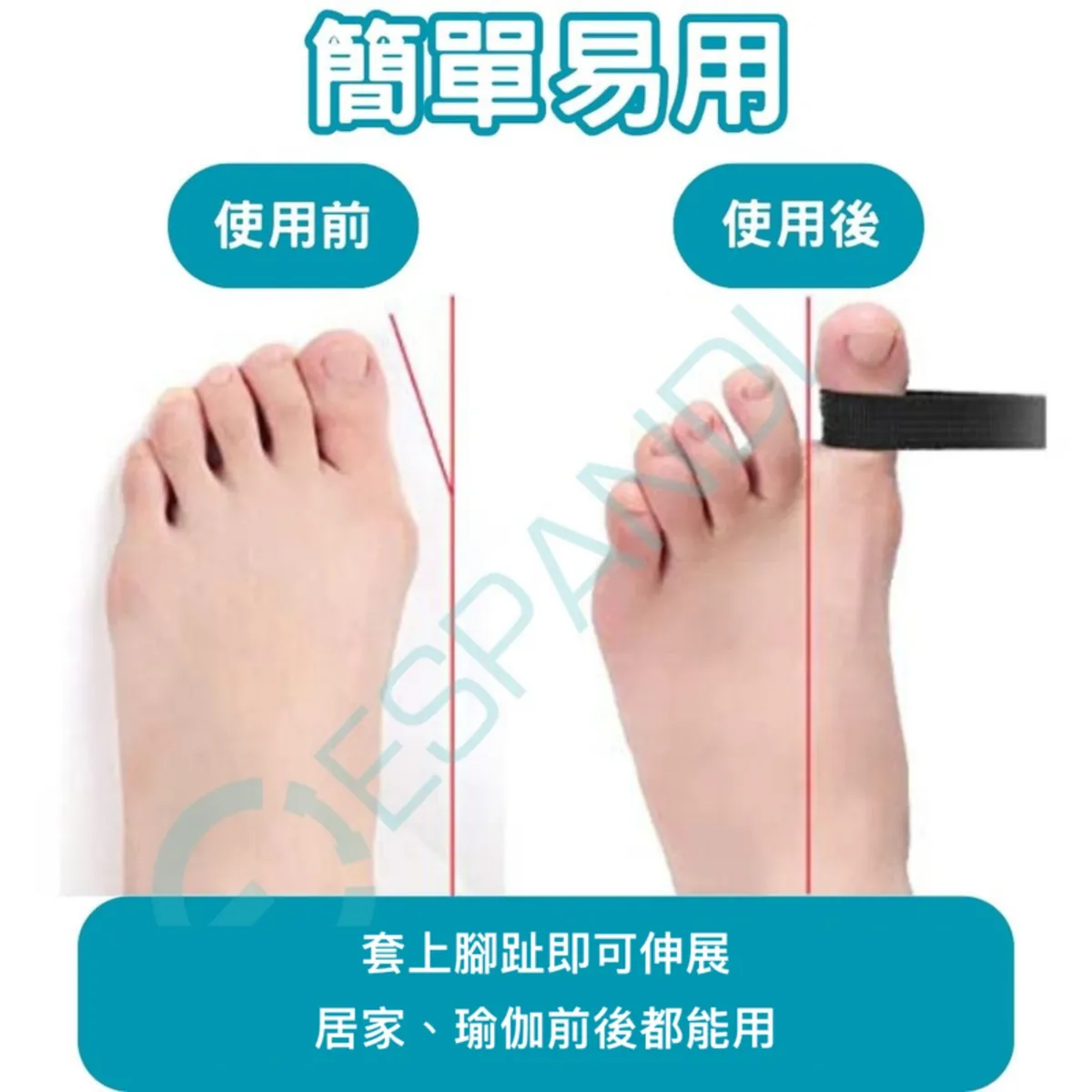 Espandi toe stretching trainer, easy to use, shown being worn, comfortable fit around the toes