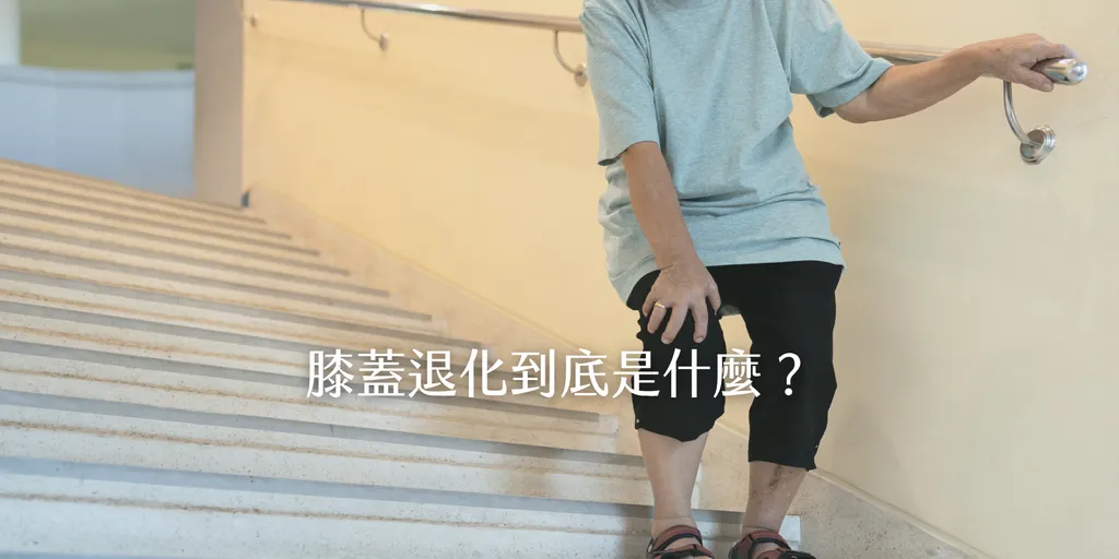 退化性膝關節炎示意圖－長者下樓梯膝蓋痛、手扶扶手忍痛