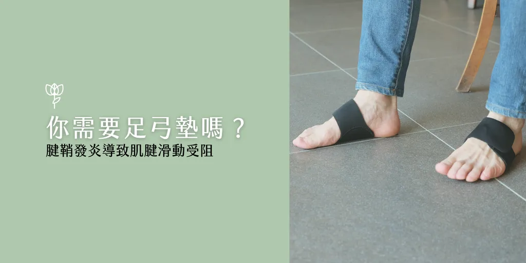 雙腳穿戴黑色足弓墊行走-你需要足弓墊嗎-腱鞘發炎肌腱滑動受阻-Espandi Sport足弓支撐
