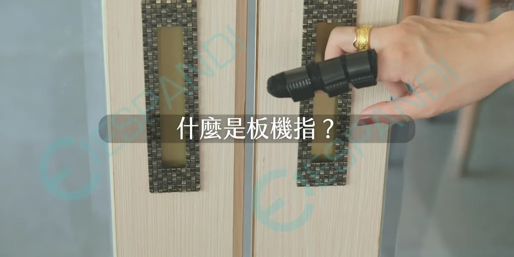 由物理治療角度，帶你搞懂板機指的成因