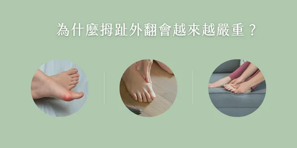 為什麼拇指外翻會越來越明顯？遺傳、鞋型、足部不適示意圖