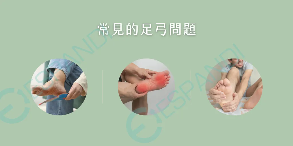 3招照顧足弓方法-赤腳訓練-穿鞋選擇-體重控制-足弓健康指南