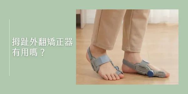 拇指外翻護具怎麼用？雙腳穿戴可調式支撐帶站立示範