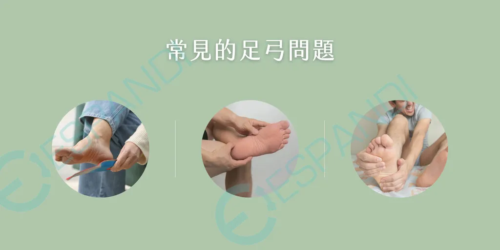 3招照顧足弓方法-赤腳訓練-穿鞋選擇-體重控制-足弓健康指南