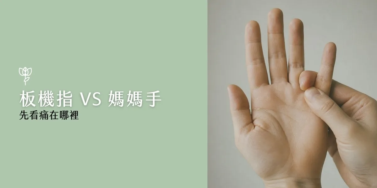 板機指 vs 媽媽手:先看痛在哪裡,按壓手指根部確認疼痛位置
