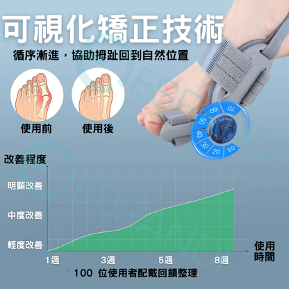 旋鈕式姆趾矯正器｜精準調整，貼合不同腳型 Dial-Adjustable Bunion Corrector