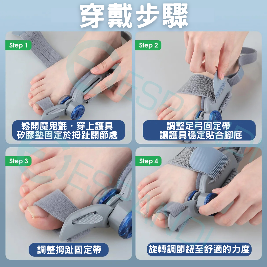 旋鈕式姆趾矯正器｜精準調整，貼合不同腳型 Dial-Adjustable Bunion Corrector