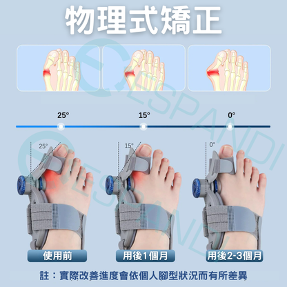 旋鈕式姆趾矯正器｜精準調整，貼合不同腳型 Dial-Adjustable Bunion Corrector